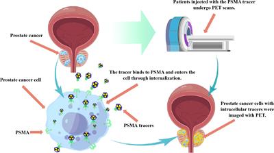 Application of targeted diagnosis of PSMA in the modality shift of prostate cancer diagnosis: a review